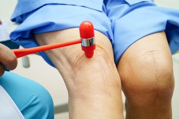 Miażdżyca nóg objawy i leczenie które warto znać