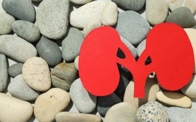 Jak pozbyć się kamieni nerkowych według użytkowników na forum?