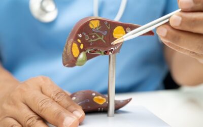 Stłuszczenie wątroby jak długo się leczy i co wpływa na czas terapii?